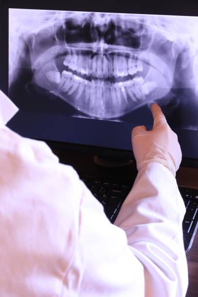 Best Emergency Dentist for Knocked-Out Tooth in Mineville, NY