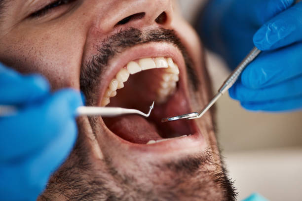 Best Pediatric Emergency Dentist in Mineville, NY